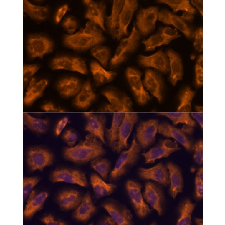 Immunofluorescence - Anti-PTRF Antibody (A305754) - Antibodies.com