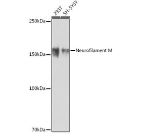 Western Blot - Anti-160 kD Neurofilament Medium Antibody [ARC0396] (A305755) - Antibodies.com