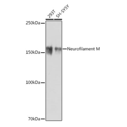 Western Blot - Anti-160 kD Neurofilament Medium Antibody [ARC0396] (A305755) - Antibodies.com