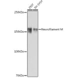 Western Blot - Anti-160 kD Neurofilament Medium Antibody [ARC0396] (A305755) - Antibodies.com