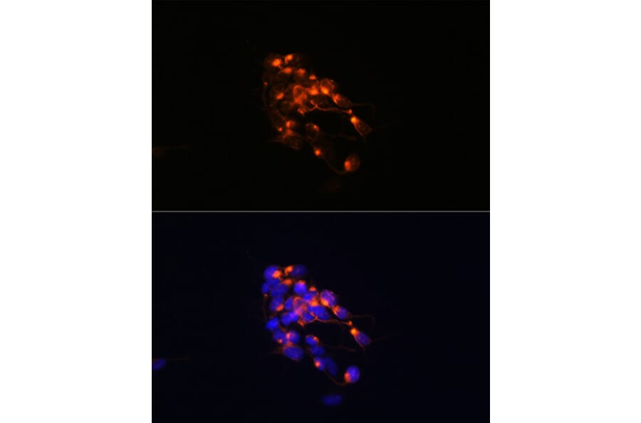 Immunofluorescence - Anti-160 kD Neurofilament Medium Antibody [ARC0396] (A305755) - Antibodies.com