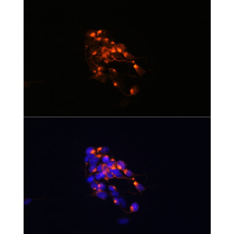 Immunofluorescence - Anti-160 kD Neurofilament Medium Antibody [ARC0396] (A305755) - Antibodies.com