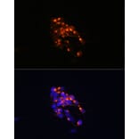 Immunofluorescence - Anti-160 kD Neurofilament Medium Antibody [ARC0396] (A305755) - Antibodies.com