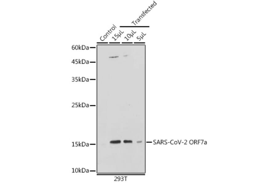 Western Blot - Anti-SARS-CoV2 ORF7a Antibody (A305756) - Antibodies.com
