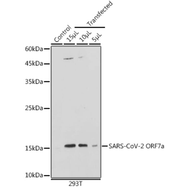 Western Blot - Anti-SARS-CoV2 ORF7a Antibody (A305756) - Antibodies.com