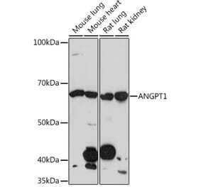 Western Blot - Anti-Angiopoietin 1 Antibody [ARC0248] (A305757) - Antibodies.com