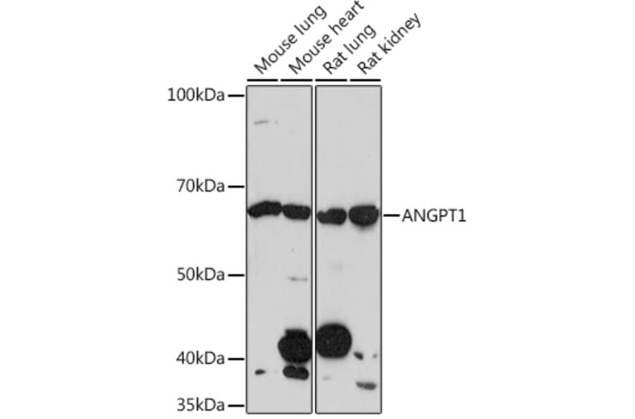 Western Blot - Anti-Angiopoietin 1 Antibody [ARC0248] (A305757) - Antibodies.com