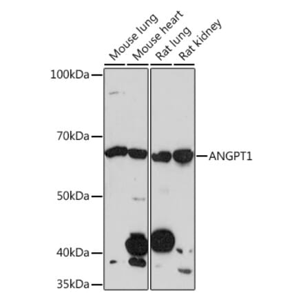 Western Blot - Anti-Angiopoietin 1 Antibody [ARC0248] (A305757) - Antibodies.com