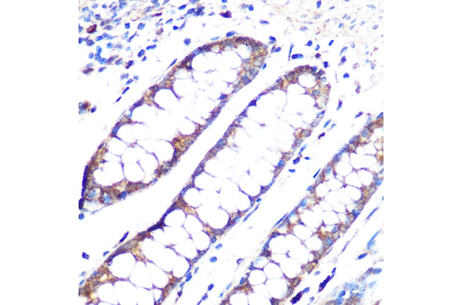 Immunohistochemistry - Anti-Angiopoietin 1 Antibody [ARC0248] (A305757) - Antibodies.com
