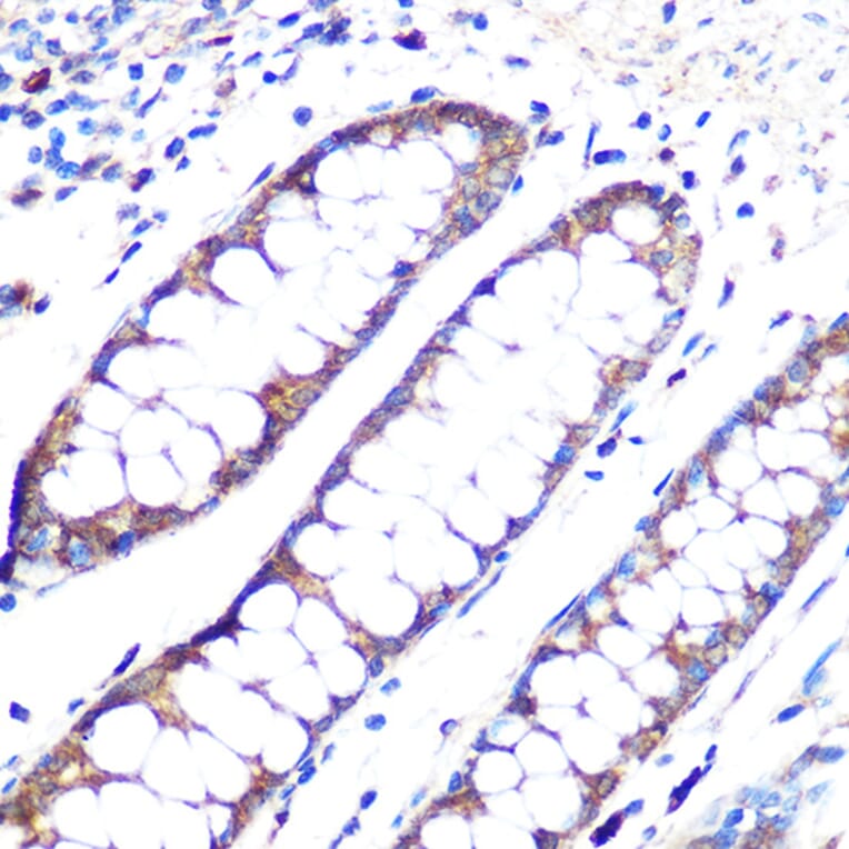 Immunohistochemistry - Anti-Angiopoietin 1 Antibody [ARC0248] (A305757) - Antibodies.com