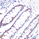 Immunohistochemistry - Anti-Angiopoietin 1 Antibody [ARC0248] (A305757) - Antibodies.com