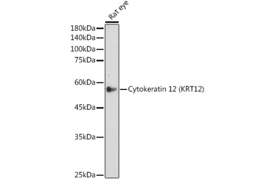 Western Blot - Anti-Keratin 12/K12 Antibody [ARC2465] (A305758) - Antibodies.com