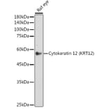 Western Blot - Anti-Keratin 12/K12 Antibody [ARC2465] (A305758) - Antibodies.com