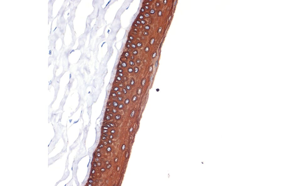 Immunohistochemistry - Anti-Keratin 12/K12 Antibody [ARC2465] (A305758) - Antibodies.com