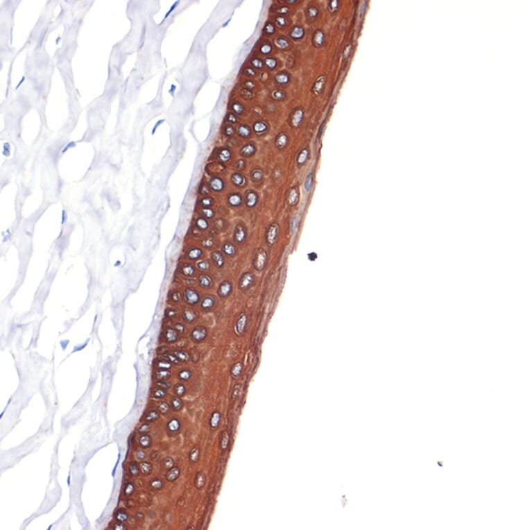Immunohistochemistry - Anti-Keratin 12/K12 Antibody [ARC2465] (A305758) - Antibodies.com