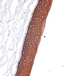 Immunohistochemistry - Anti-Keratin 12/K12 Antibody [ARC2465] (A305758) - Antibodies.com