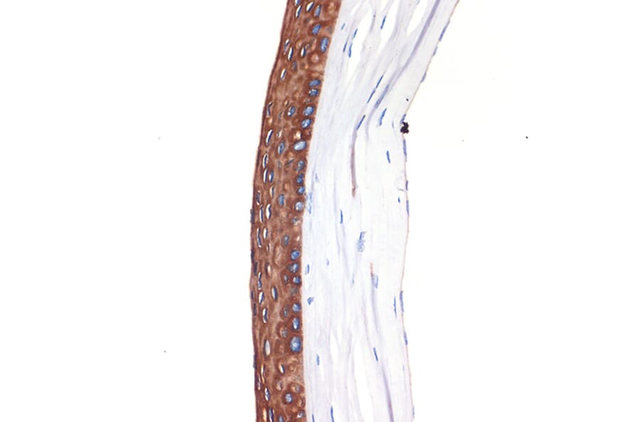 Immunohistochemistry - Anti-Keratin 12/K12 Antibody [ARC2465] (A305758) - Antibodies.com