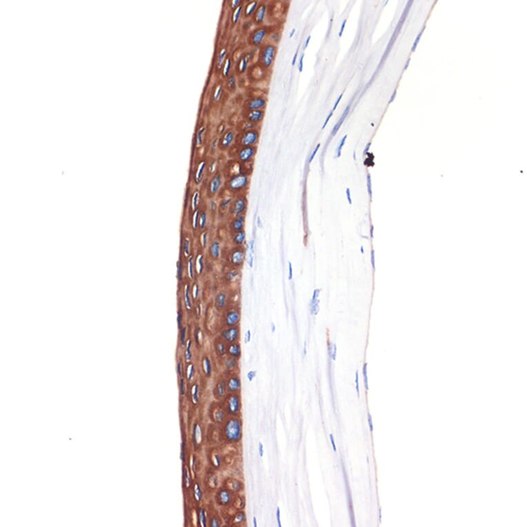 Immunohistochemistry - Anti-Keratin 12/K12 Antibody [ARC2465] (A305758) - Antibodies.com