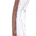 Immunohistochemistry - Anti-Keratin 12/K12 Antibody [ARC2465] (A305758) - Antibodies.com
