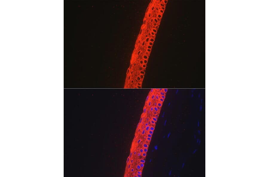 Immunofluorescence - Anti-Keratin 12/K12 Antibody [ARC2465] (A305758) - Antibodies.com
