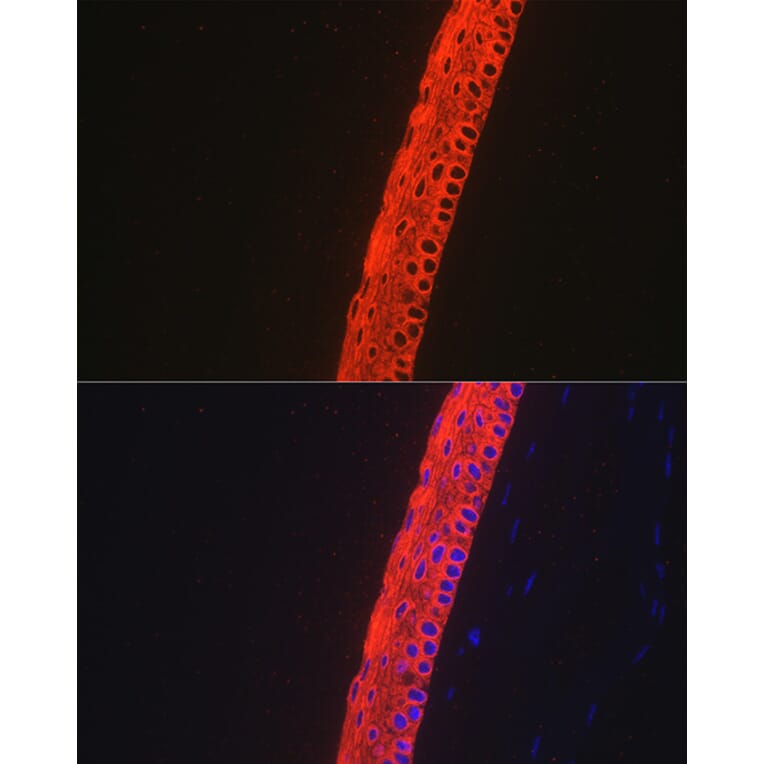 Immunofluorescence - Anti-Keratin 12/K12 Antibody [ARC2465] (A305758) - Antibodies.com