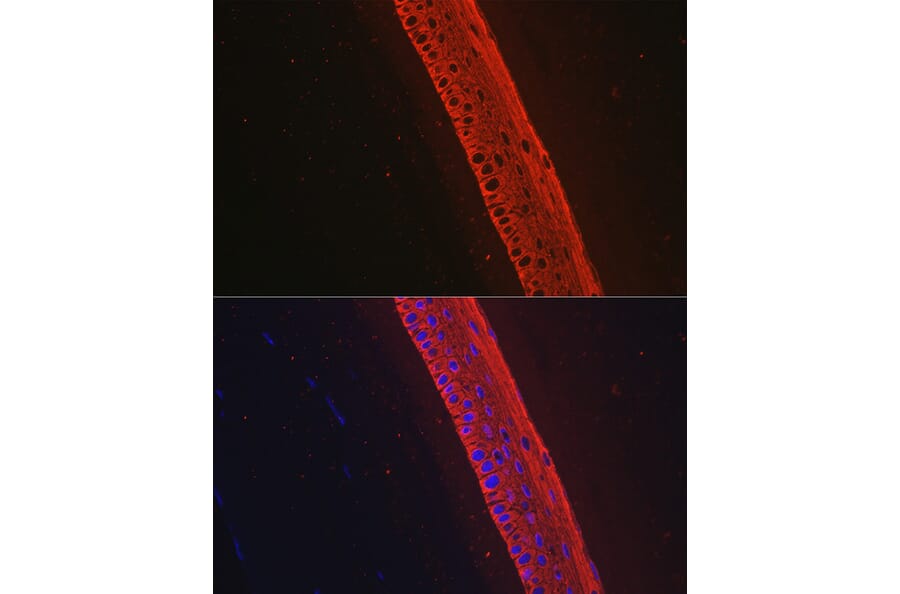 Immunofluorescence - Anti-Keratin 12/K12 Antibody [ARC2465] (A305758) - Antibodies.com