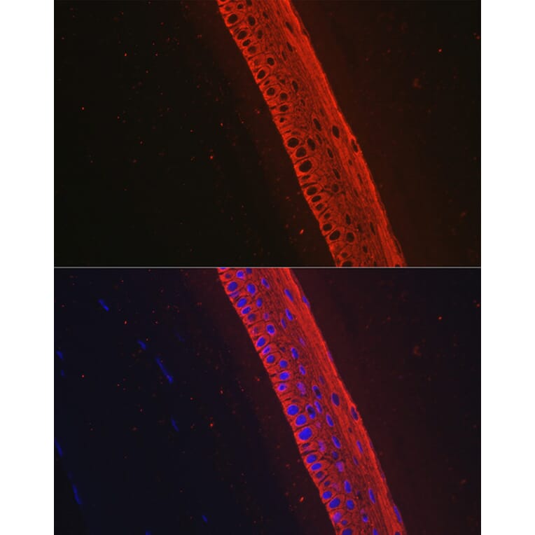 Immunofluorescence - Anti-Keratin 12/K12 Antibody [ARC2465] (A305758) - Antibodies.com