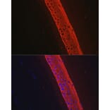 Immunofluorescence - Anti-Keratin 12/K12 Antibody [ARC2465] (A305758) - Antibodies.com