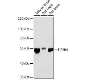 Western Blot - Anti-eIF2B4 Antibody (A305759) - Antibodies.com