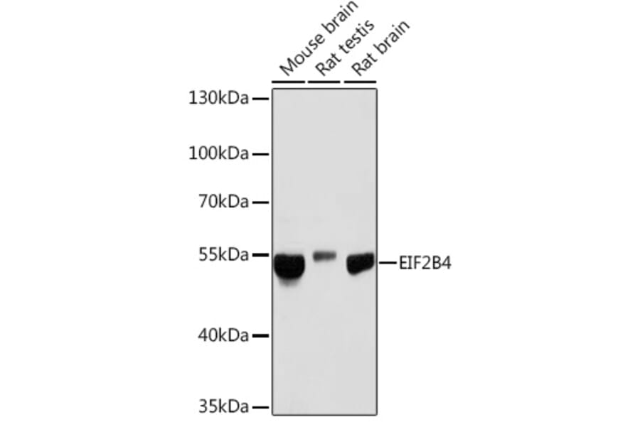 Western Blot - Anti-eIF2B4 Antibody (A305759) - Antibodies.com