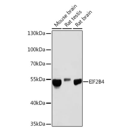 Western Blot - Anti-eIF2B4 Antibody (A305759) - Antibodies.com