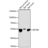 Western Blot - Anti-eIF2B4 Antibody (A305759) - Antibodies.com