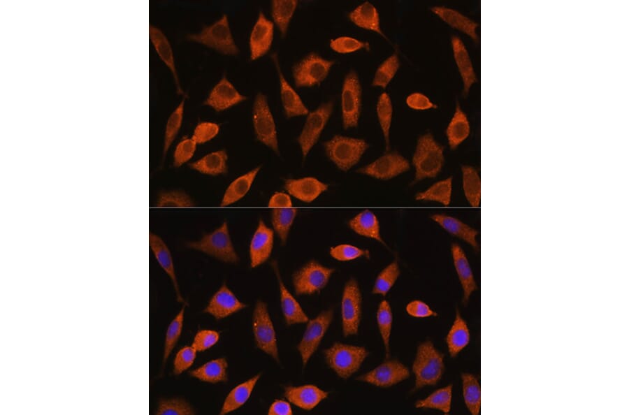 Immunofluorescence - Anti-eIF2B4 Antibody (A305759) - Antibodies.com