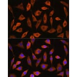 Immunofluorescence - Anti-eIF2B4 Antibody (A305759) - Antibodies.com