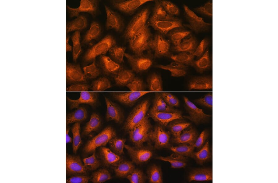 Immunofluorescence - Anti-eIF2B4 Antibody (A305759) - Antibodies.com
