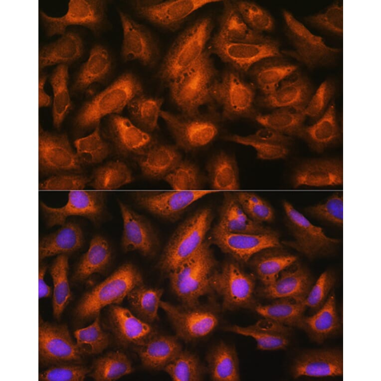 Immunofluorescence - Anti-eIF2B4 Antibody (A305759) - Antibodies.com