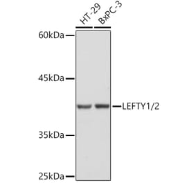 Western Blot - Anti-Lefty Antibody [ARC2149] (A305760) - Antibodies.com