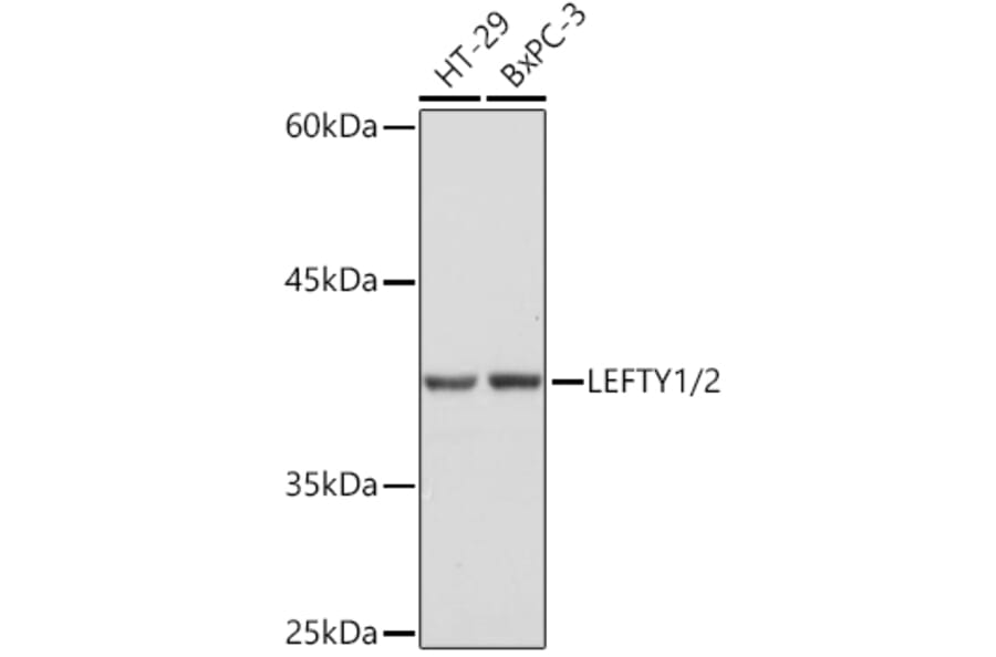 Western Blot - Anti-Lefty Antibody [ARC2149] (A305760) - Antibodies.com