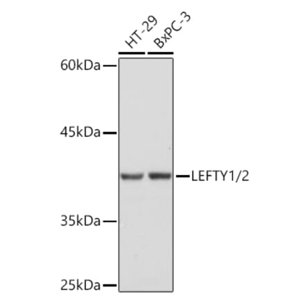 Western Blot - Anti-Lefty Antibody [ARC2149] (A305760) - Antibodies.com