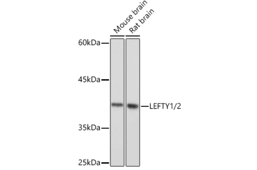 Western Blot - Anti-Lefty Antibody [ARC2149] (A305760) - Antibodies.com