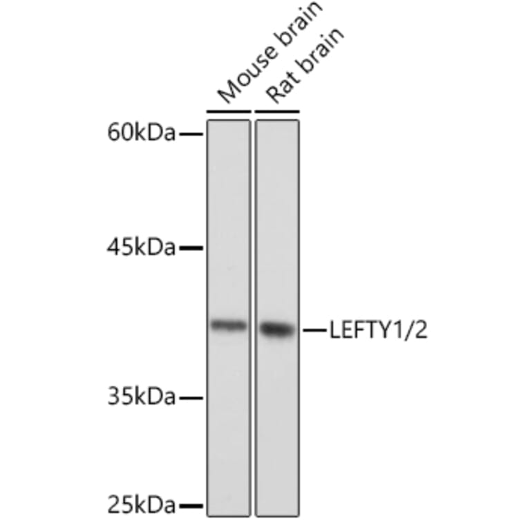 Western Blot - Anti-Lefty Antibody [ARC2149] (A305760) - Antibodies.com