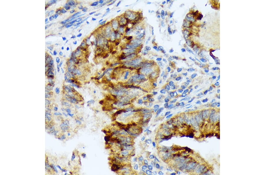 Immunohistochemistry - Anti-Lefty Antibody [ARC2149] (A305760) - Antibodies.com