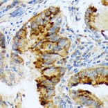 Immunohistochemistry - Anti-Lefty Antibody [ARC2149] (A305760) - Antibodies.com