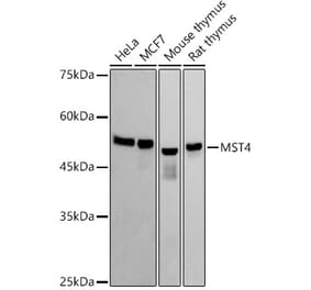 Western Blot - Anti-MST4 Antibody [ARC2953] (A305762) - Antibodies.com