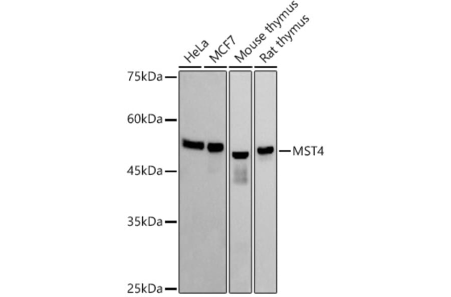 Western Blot - Anti-MST4 Antibody [ARC2953] (A305762) - Antibodies.com