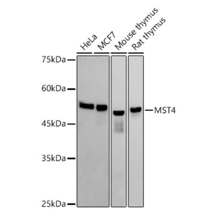 Western Blot - Anti-MST4 Antibody [ARC2953] (A305762) - Antibodies.com