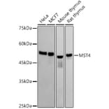 Western Blot - Anti-MST4 Antibody [ARC2953] (A305762) - Antibodies.com