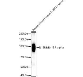 Western Blot - Anti-IL-18R1 Antibody [ARC52216] (A305763) - Antibodies.com