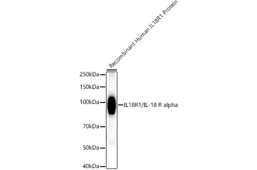 Western Blot - Anti-IL-18R1 Antibody [ARC52216] (A305763) - Antibodies.com