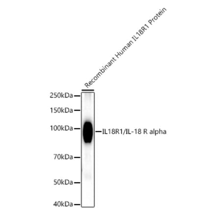 Western Blot - Anti-IL-18R1 Antibody [ARC52216] (A305763) - Antibodies.com